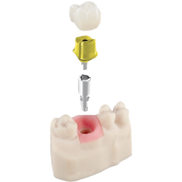 ArgenIS-1.png ArgenIS