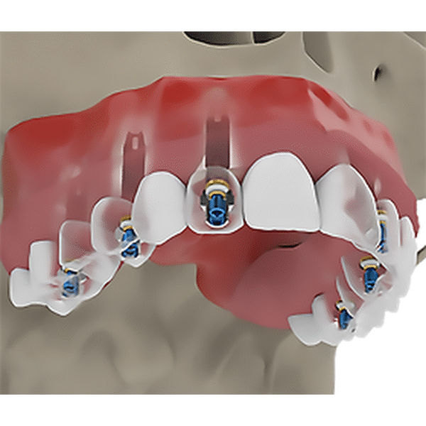 Rhein83-1.png Rhein83